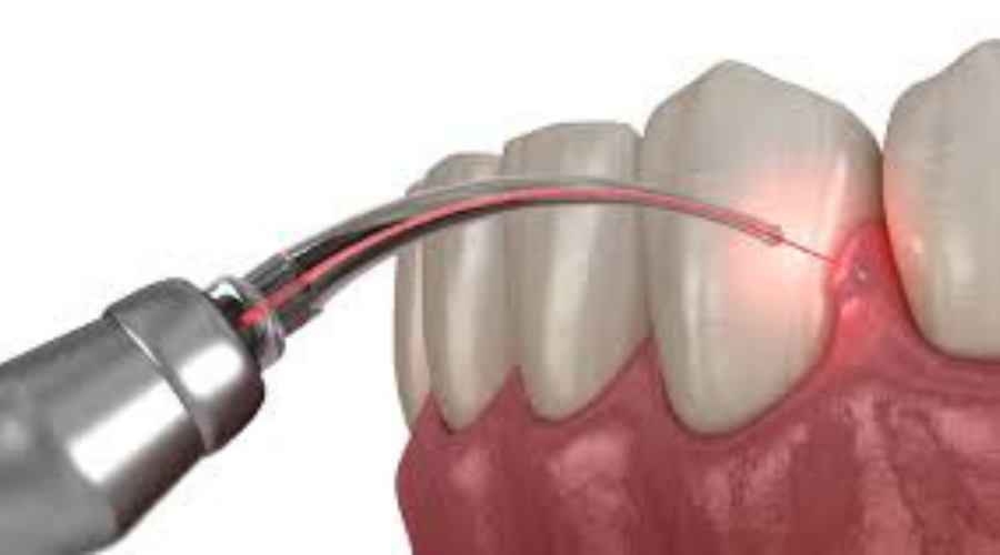 Happy person with braces